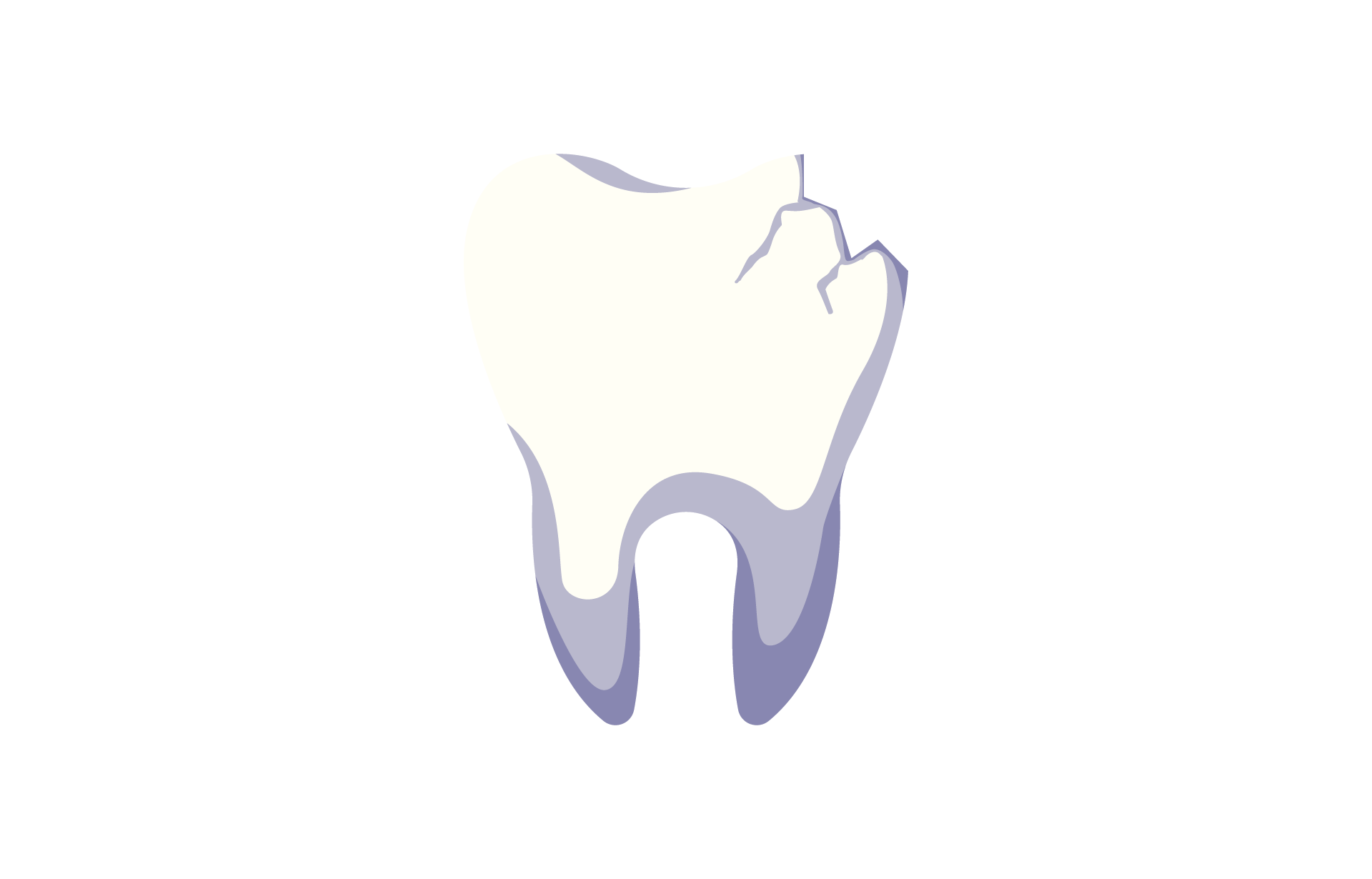 Chipped Tooth