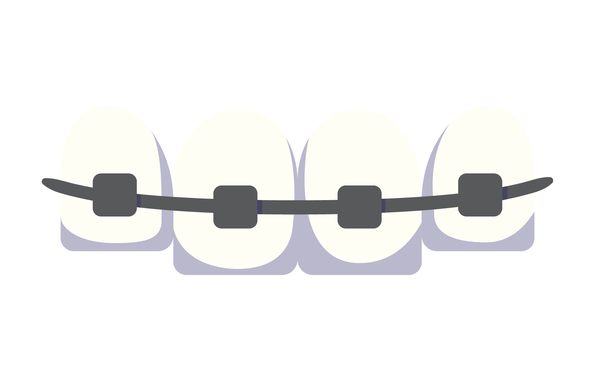 Teeth with Braces